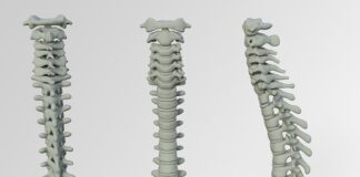 Co na wypadanie włosów Rossmann?