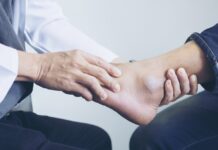 Złamanie śródstopia