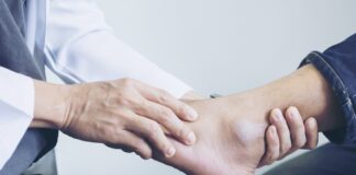 Złamanie śródstopia